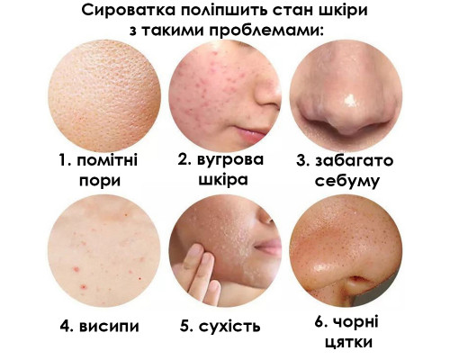 Сыворотка для лица SERSANLOVE Aloe Essence 30 мл с экстрактом алоэ